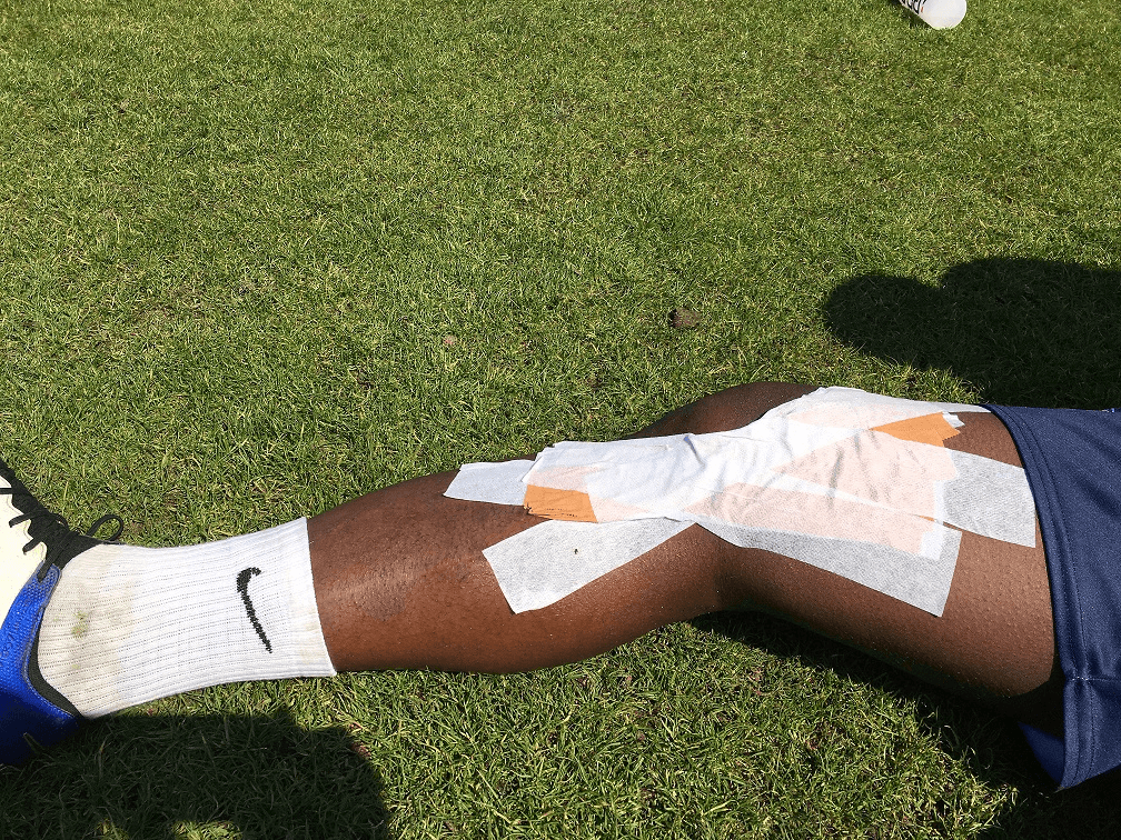 Player with a knee injury